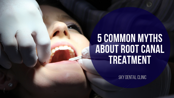 Myths about Root Canal Treatment