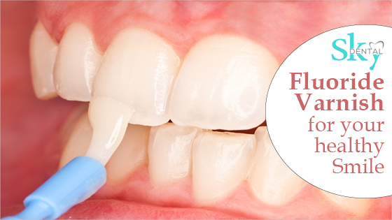 Fluoride varnish