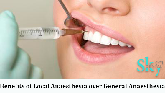 Local Anaesthesia over General Anaesthesia