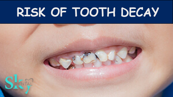 Risk of Tooth Decay