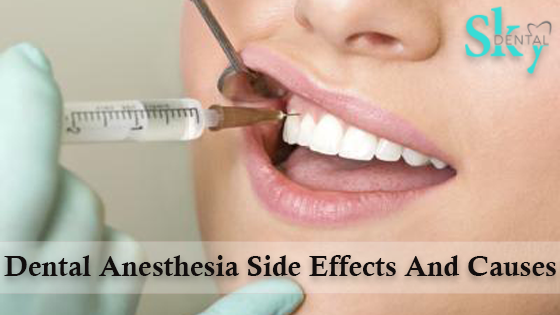 Dental Anesthesia Side Effects And Causes For Treatment