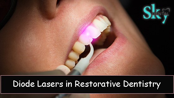 Diode Lasers in Restorative Dentistry