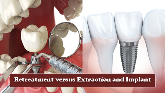 Retreatment versus Extraction and implant