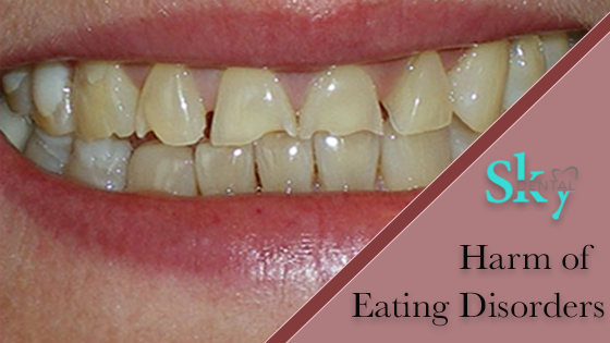 HOW EATING DISORDER CAN HARM YOUR TEETH?