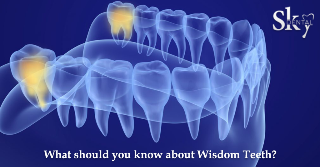 What you should know about wisdom teeth?