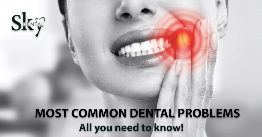 Most Common Dental Problems