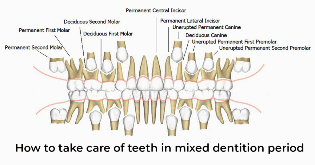 How to take care of teeth in mixed dentition period