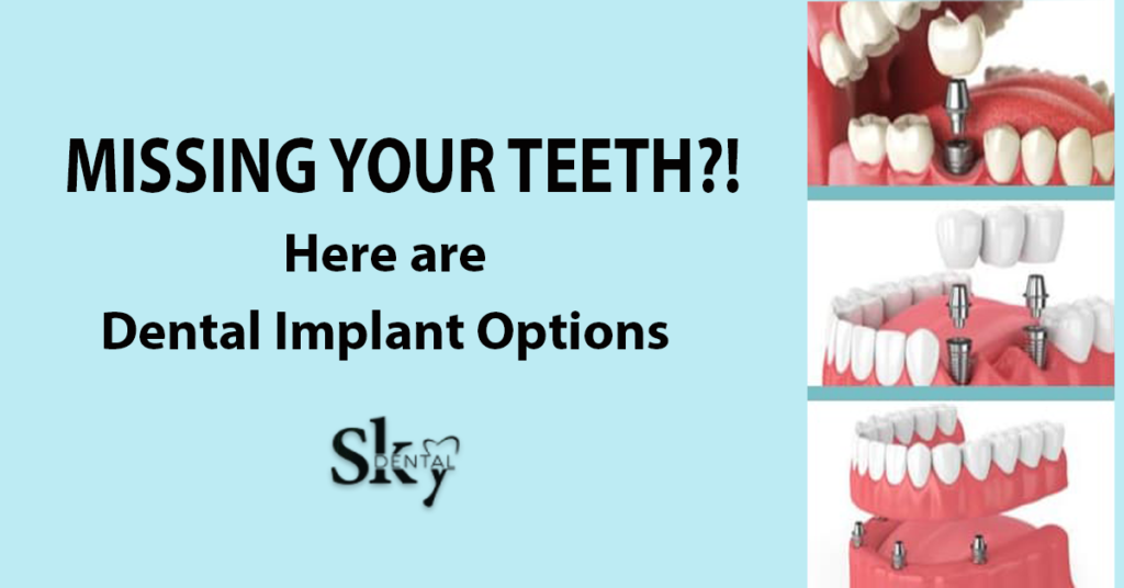 dental implant options