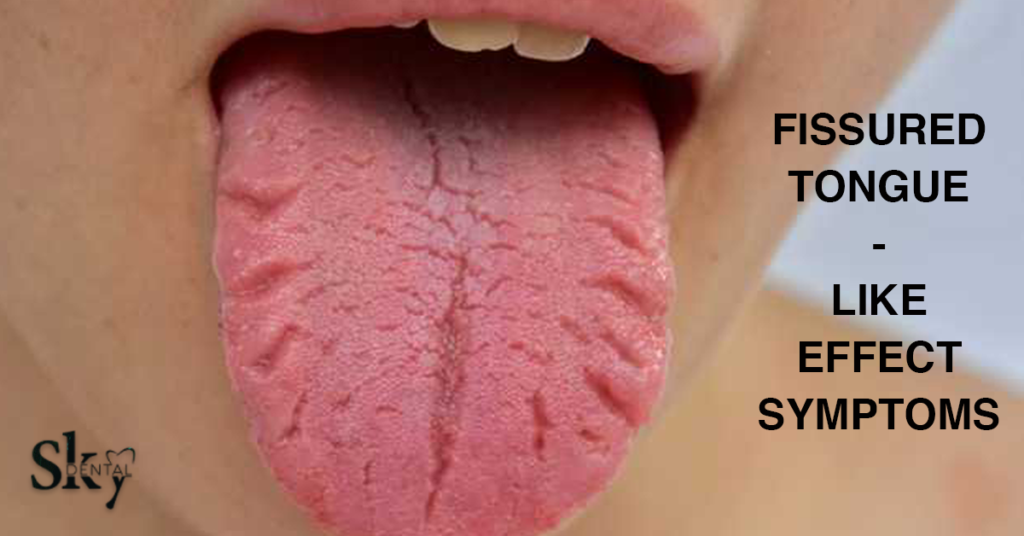 FISSURED TONGUE-LIKE EFFECT SYMPTOMS