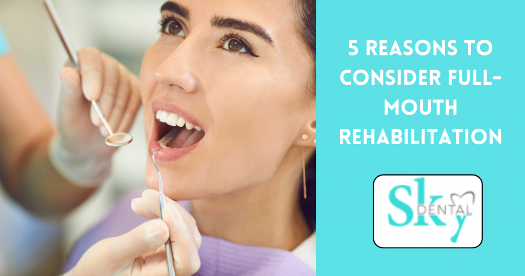 5 Reasons to Consider Full-Mouth Rehabilitation