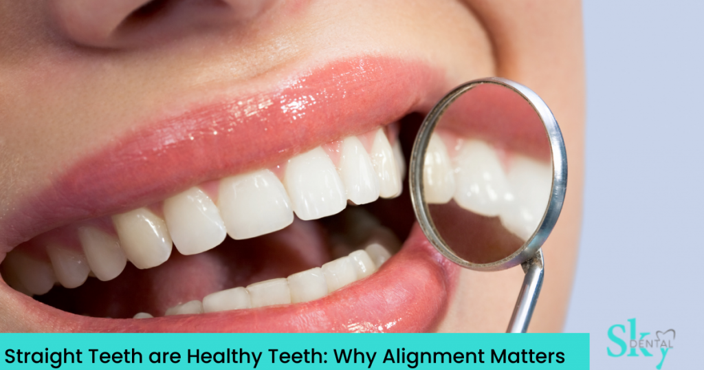 Straight Teeth are Healthy Teeth: Why Alignment Matters