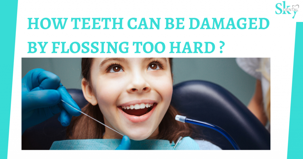 TEETH DAMAGED BY FLOSSING TOO HARD